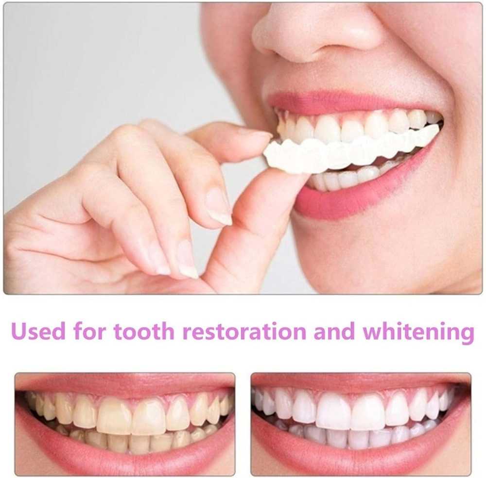 Temporary Snap-On Dentures | أسنان صناعية مؤقتة